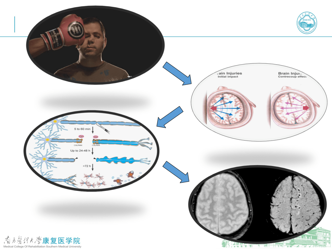 轴索再生图片