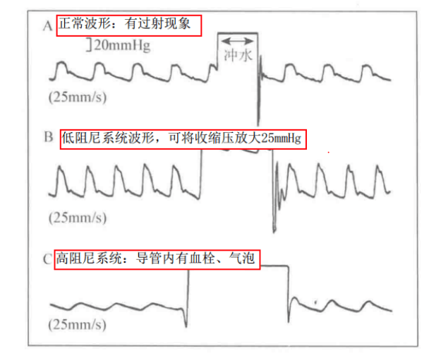 正常情况下,动脉波形有圆形波峰并带有重博切记.