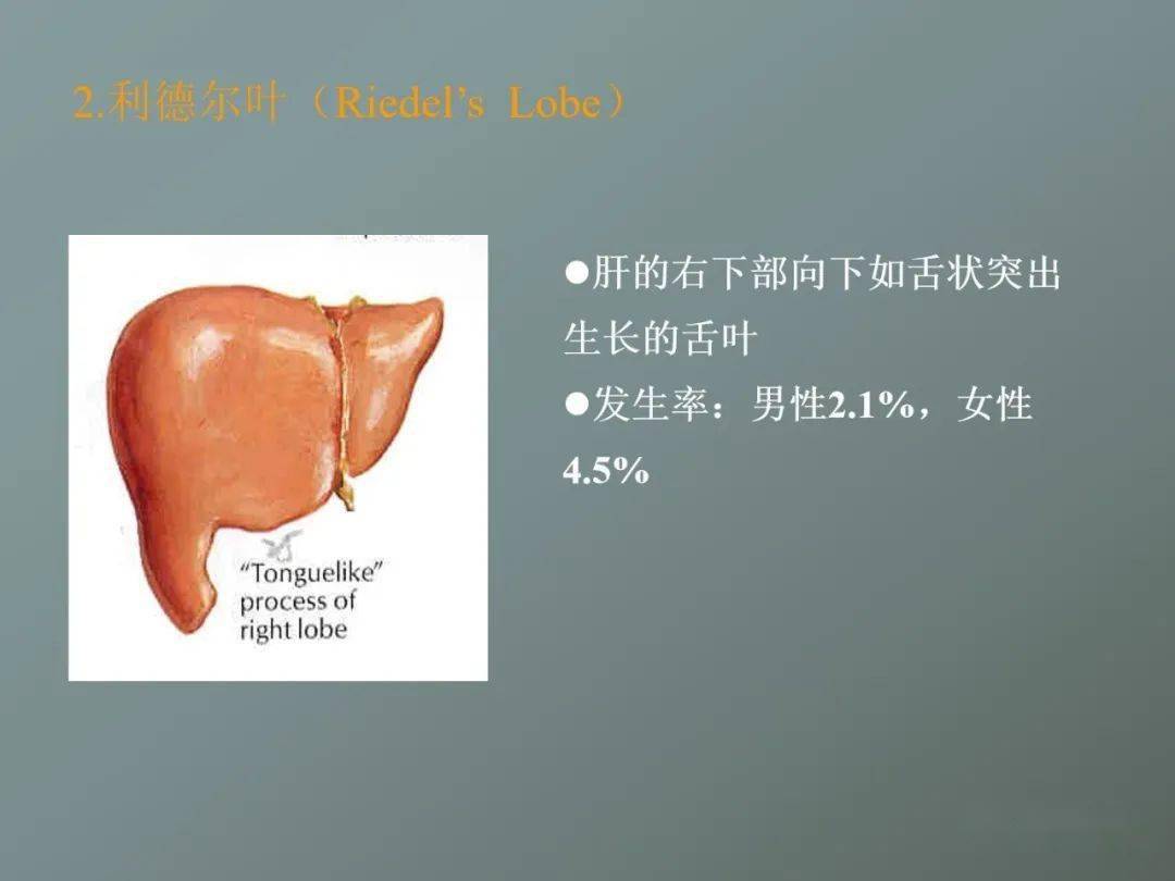少许肝组织和迷走肝管,若其内仍有完整肝组织,形成的肝叶就是"獭尾肝"