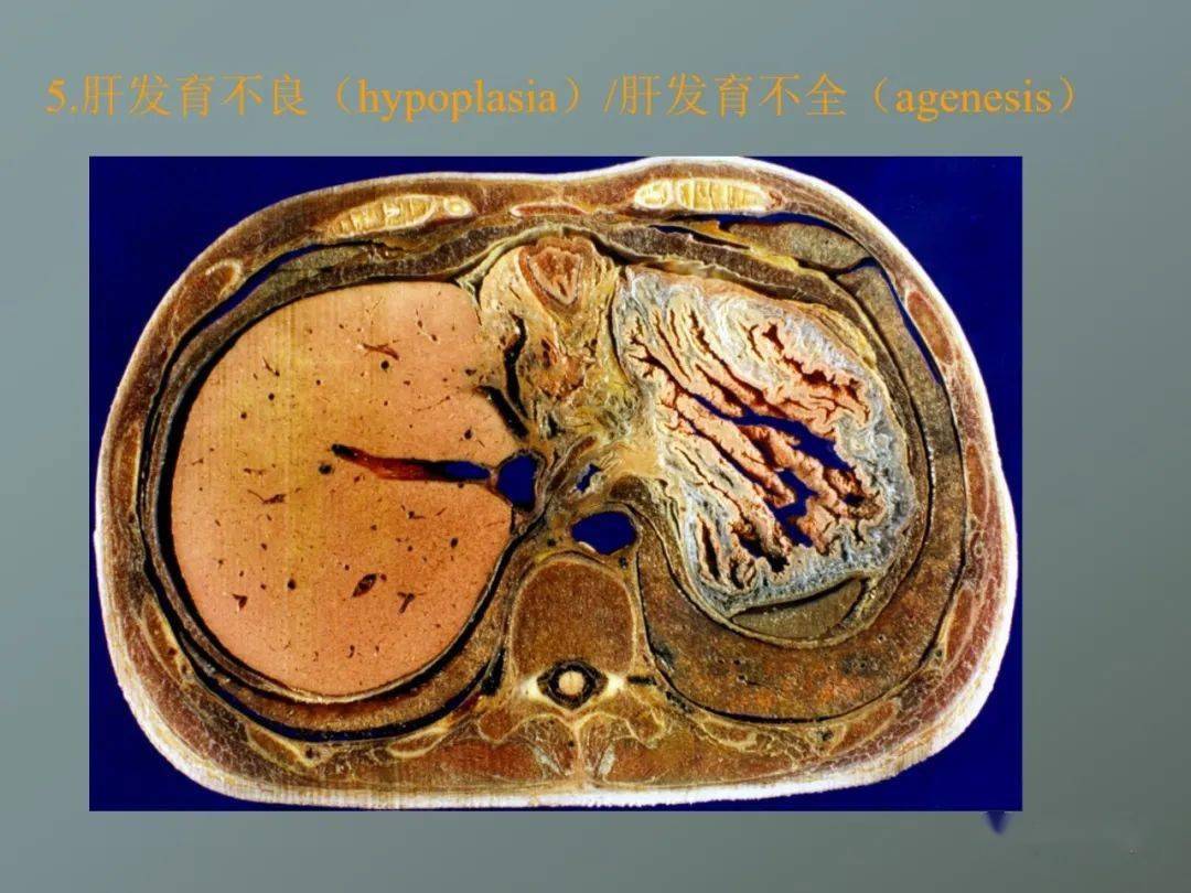 獭尾肝解剖图片图片