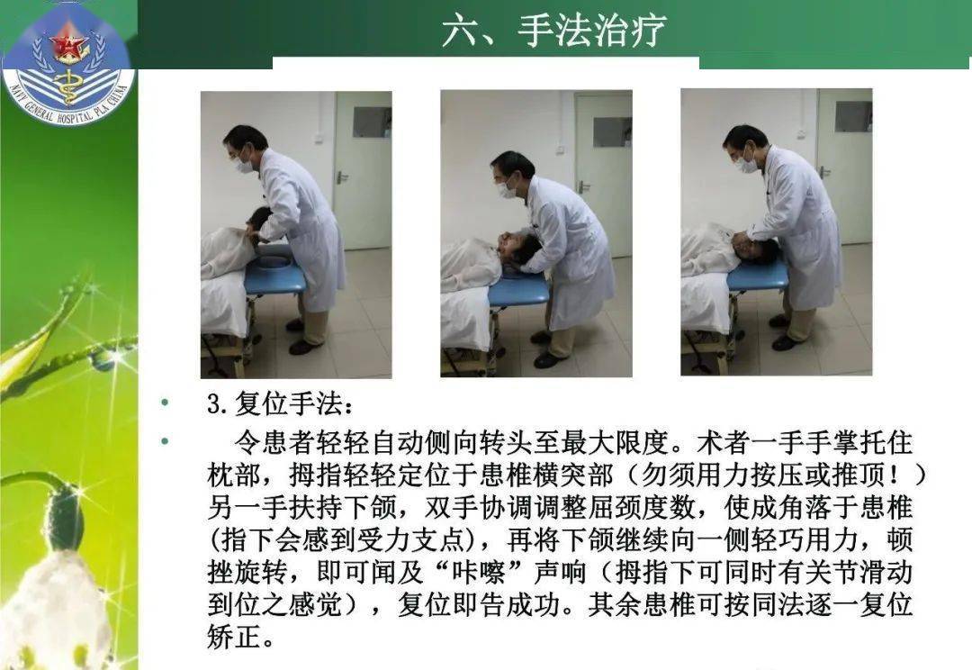 寰枢关节半脱位的针刀及手法治疗_膏药
