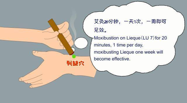 双十一谨防"腱鞘炎"