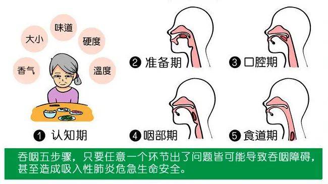 吞咽健康操,提高老人吞咽功能,预防噎食