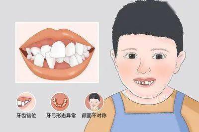 21儿童科普活动预告】呵护牙齿要从小,牙儿健康人人夸!