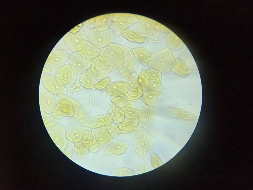 动物细胞因为没有了细胞壁的支持作用,因此不像植物细胞排列得那么