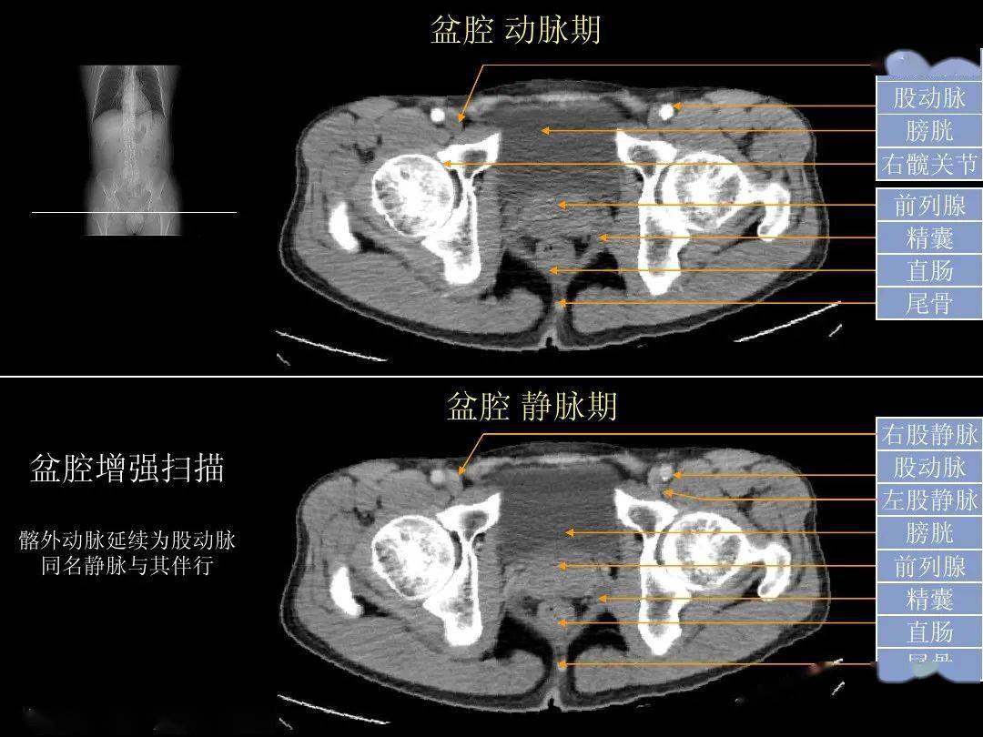 腹部ct入門解剖圖譜收藏版