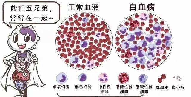 如血小板减少症患者,白血病患者,这些患者血凝机制不好,容易洗牙后
