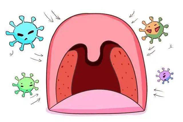 5岁儿童扁桃体角化症图片
