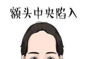 中正隆起的人丰衣足食,中正塌陷的人子女有灾祸.