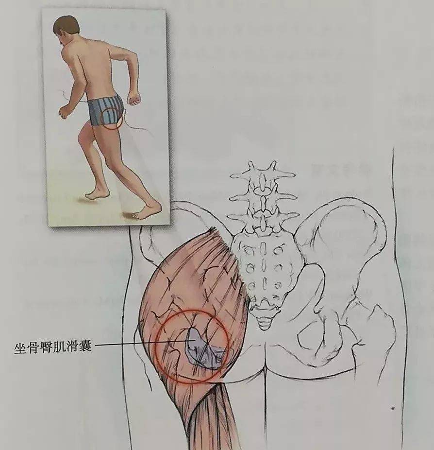 坐骨结节真人图位置图片