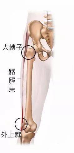 髂股韧带的作用图片