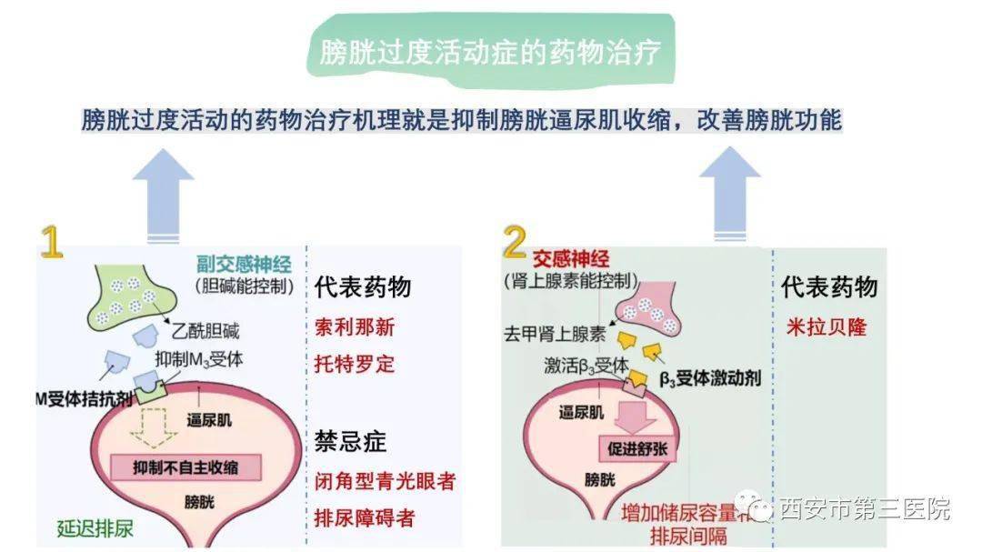 【膀胱过度活动症】为什么你总是有上不完的厕所?