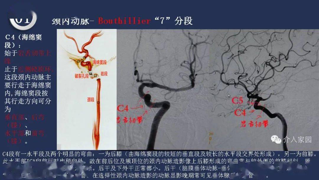 高清頭頸動脈系統解剖