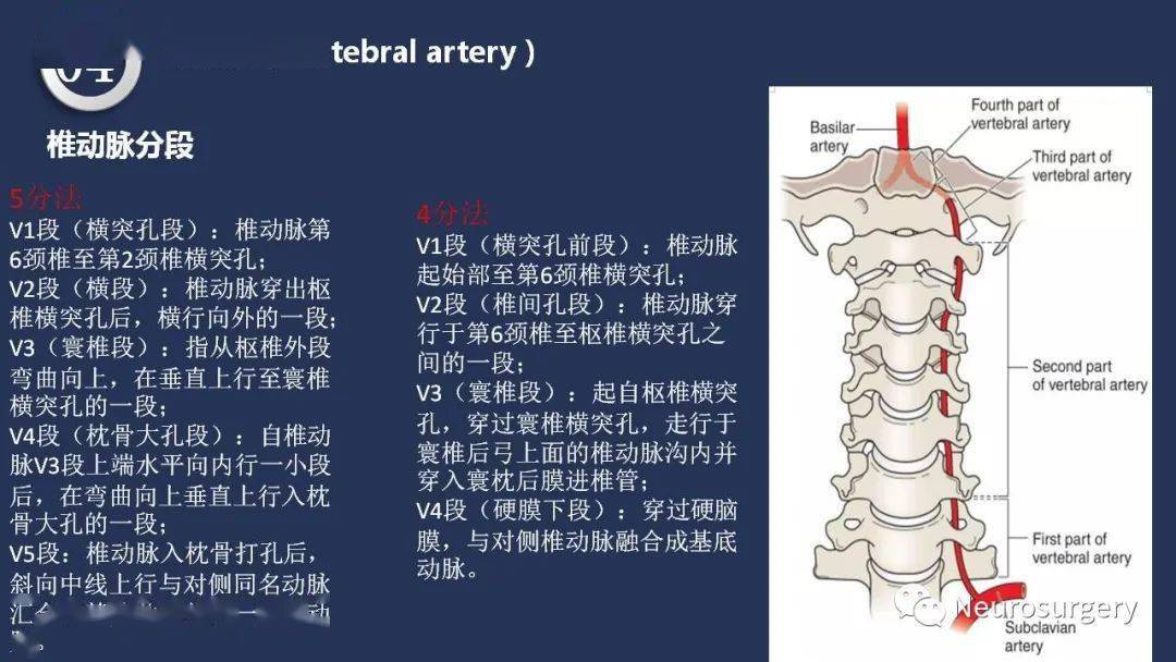 第六颈椎颈动脉结节图片