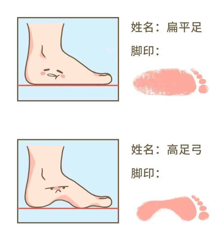 康复师:你真的了解自己的脚吗?_足部