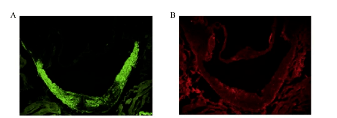 圖 5-3 小鼠主動脈根部冰凍切片免疫熒光染色採用針對特定蛋白的一抗