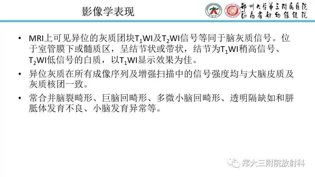 【每日一例1213】4歲男童,灰質異位的病例分析