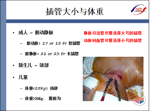 pptecmo插管技术与部位选择