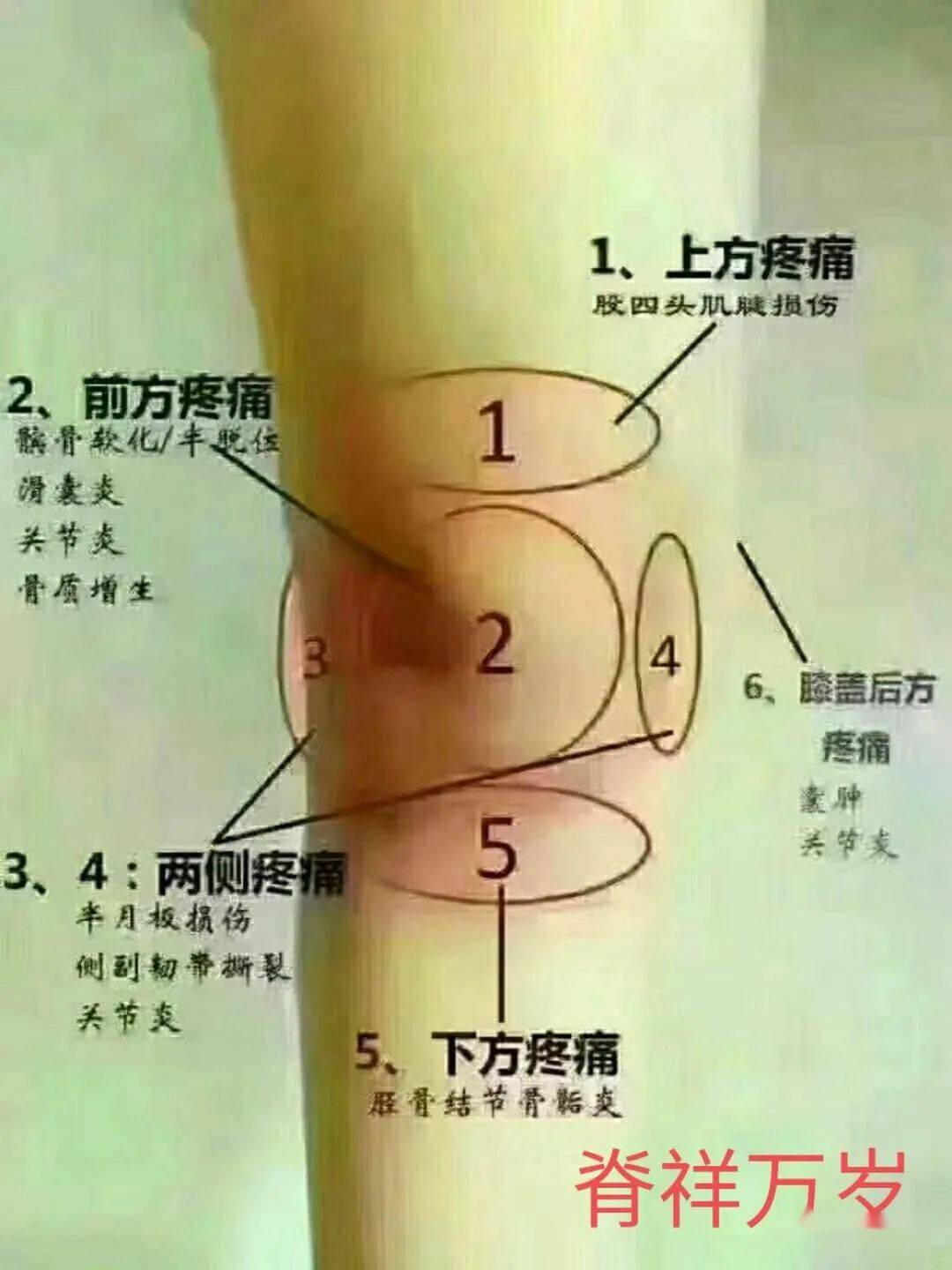 十五,足跟痛症状:足跟疼痛,脚底疼痛,脚踝疼痛治疗点:1. 外膝眼2.