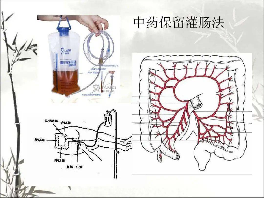 输卵管通而不畅中医治疗有方法帮助众多女性告别不孕