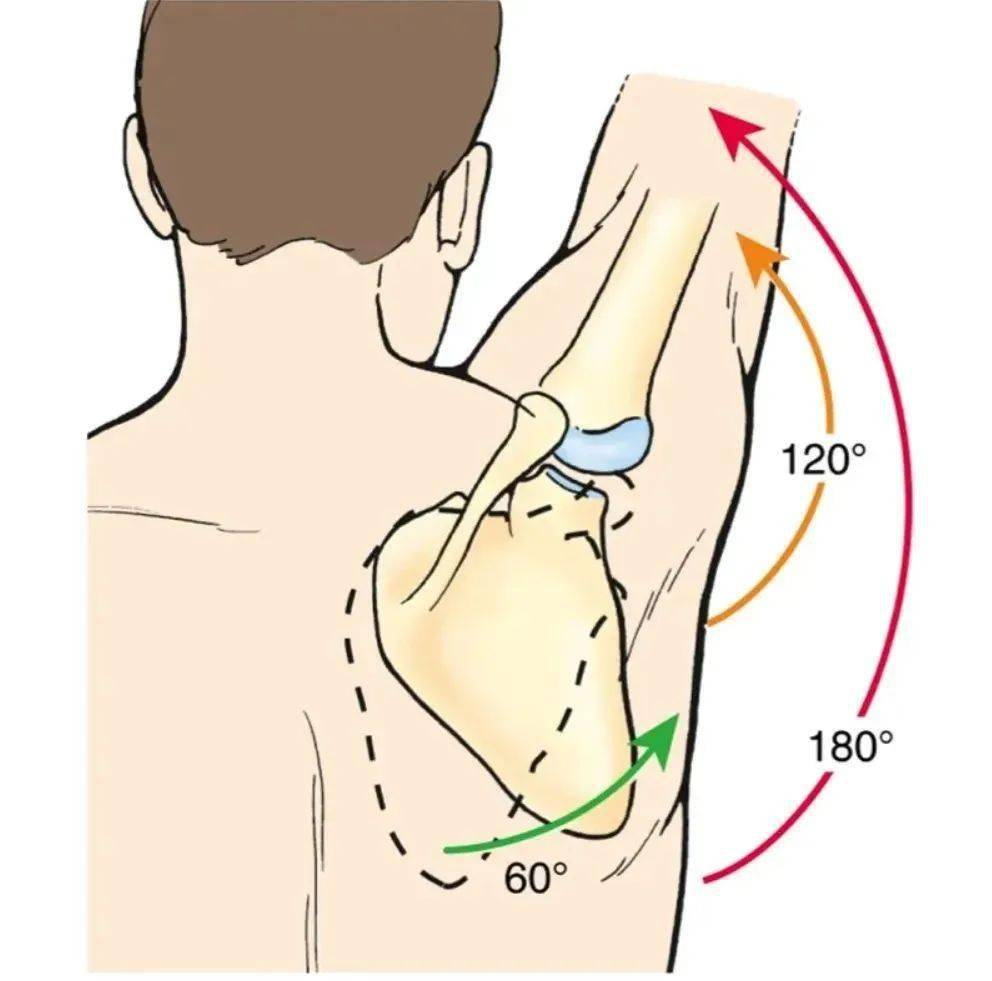 肩痛难忍抬肩困难听起来很陌生的肩峰下撞击综合征实际上很普遍