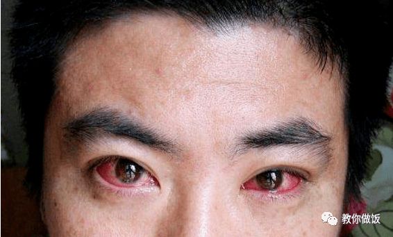 熬夜玩手机比低头族危害更大,现在放下手机还来的及!_眼睛