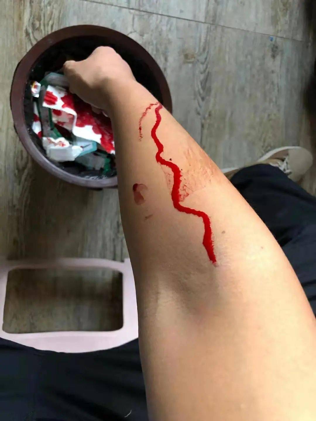 心胸有堵感觉压抑多拍打胳膊肘膝盖窝