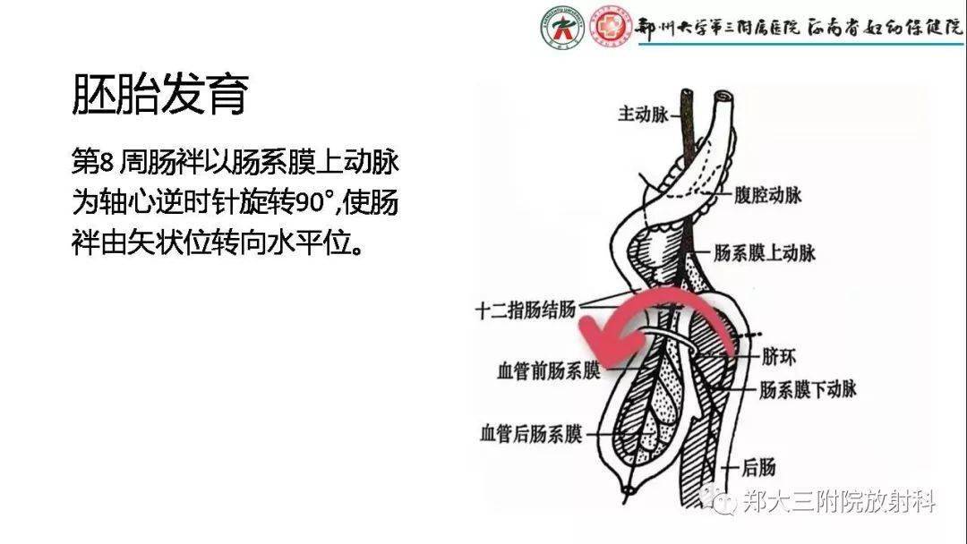 先天性肠旋转不良的影像诊断