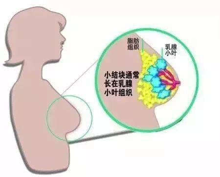 为什么十个女人九个乳腺增生?_乳房