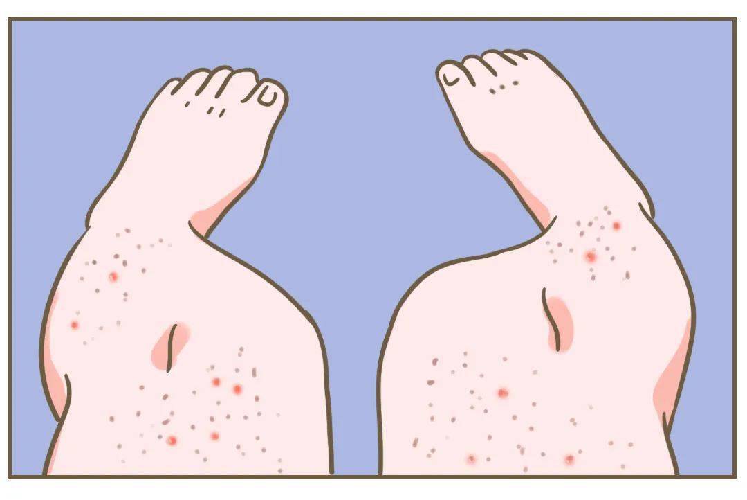 关于脑袋有块鸡皮肤定不住嘎巴的信息