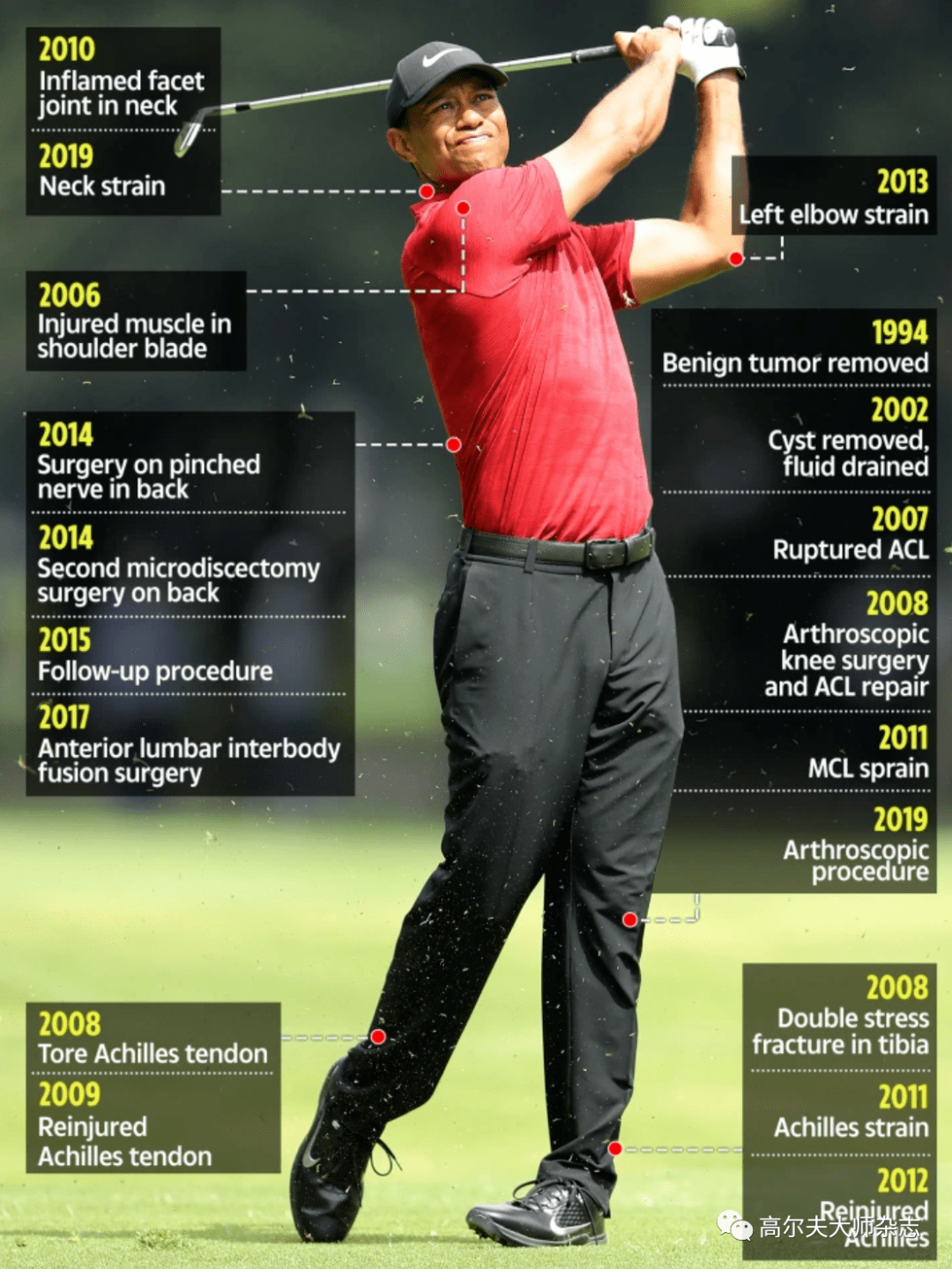 第5次背部手术“成功”！45岁的老虎还能再创辉煌吗？_搜狐网