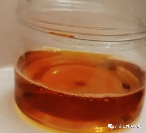 尿液浮着一层油图片图片