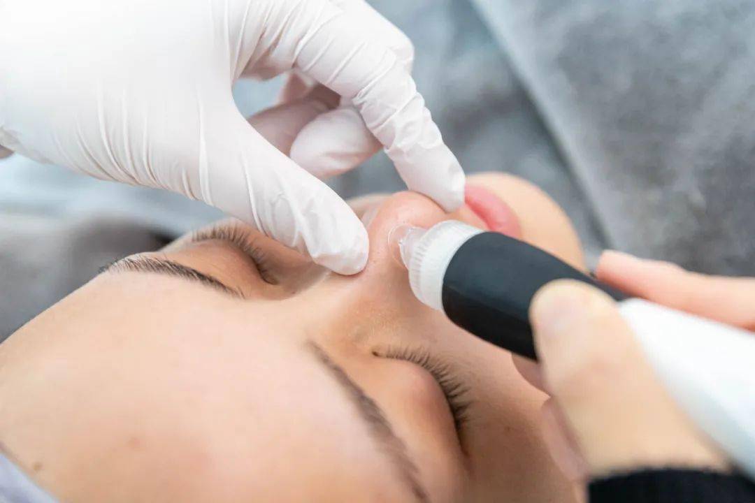 0699抢小气泡护理14折抢殿堂级美容项目冬天变美秘籍被我找到了