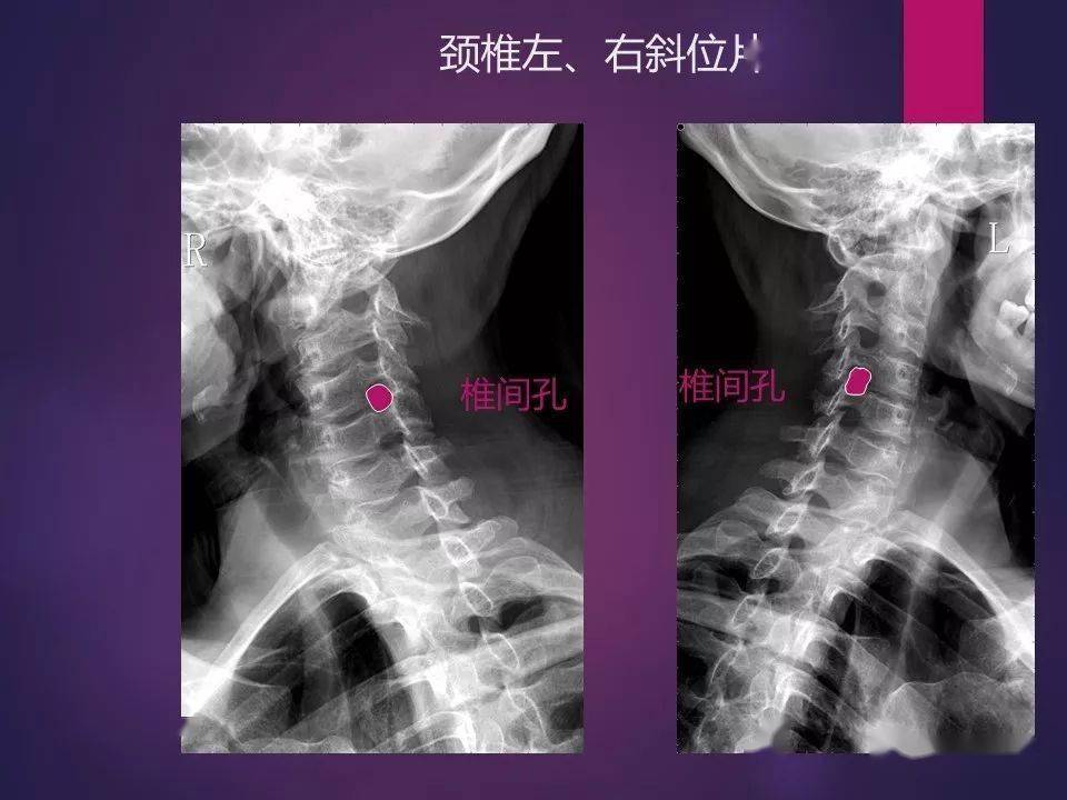正常人骨骼图全身 搜狗图片搜索