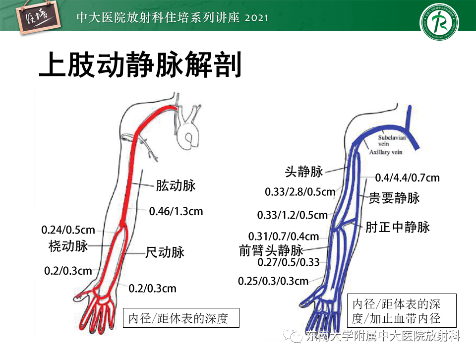 手臂静脉 解剖图图片