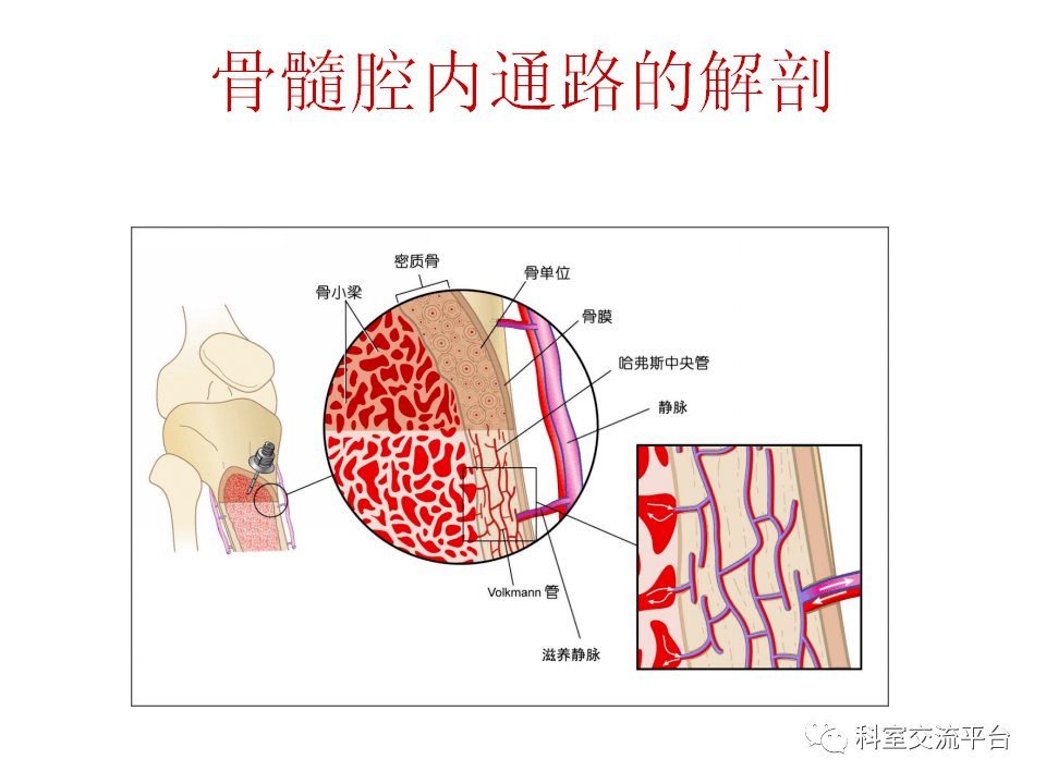 wow,增强扫描可以不经静脉?骨髓腔内注射你一定要了解