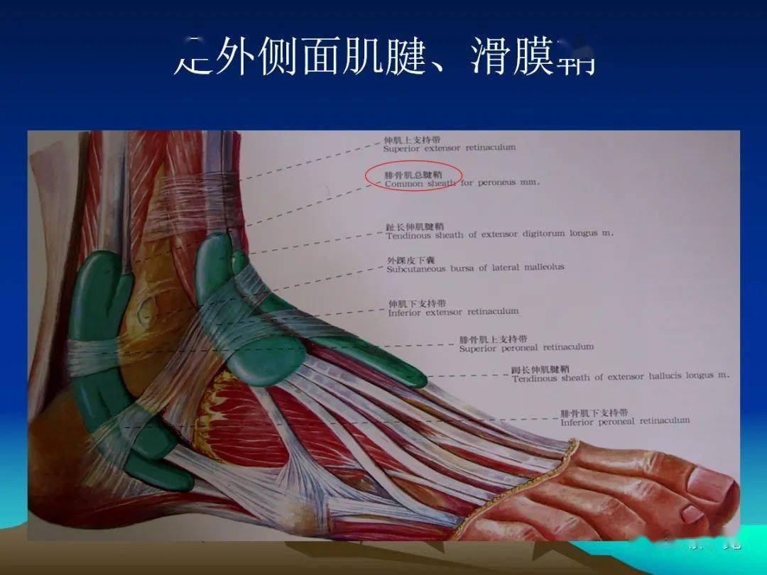 外侧弓状韧带图片