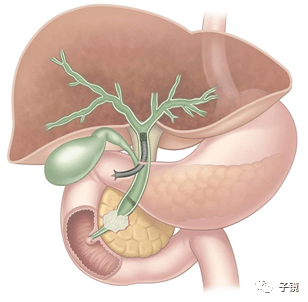 3,在恶性梗阻性黄疸治疗中具有成为和ercpptbd同样首次选项之一的潜力