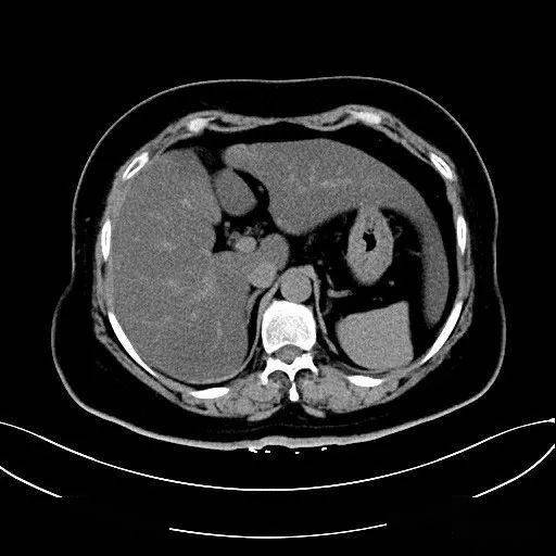 獭尾肝解剖图片图片