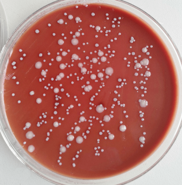 鹑鸡肠球菌的天然耐药图片
