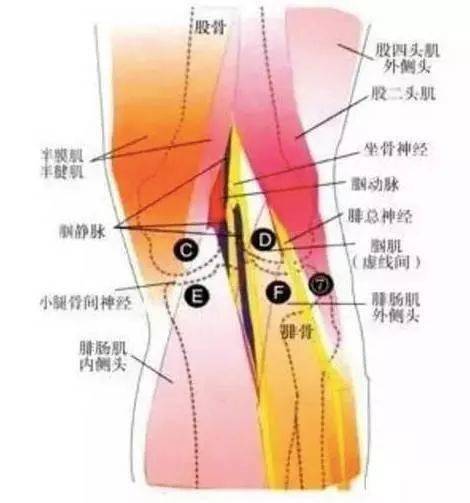 膝关节强直的针刀定点操作及手法治疗
