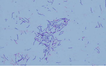 按照惯例,又对菌落进行一个革兰染色涂片:菌落特写:菌落呈粗糙颗粒状