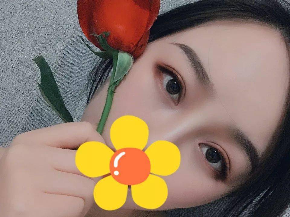 【双眼皮案例】这双眼皮做得好好看,妈生感超强!