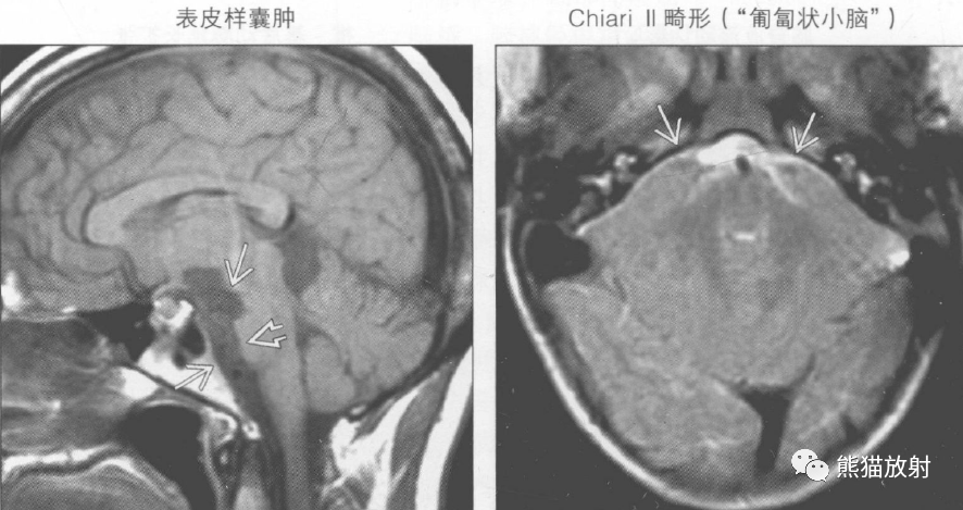 鉴别诊断