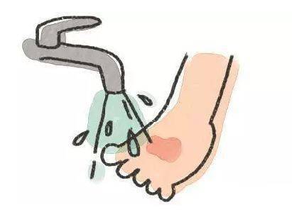 冷水冲是烫伤处理最关键的一步,是第一选择,越快越好!