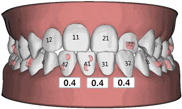 成人牙齿编号位置图图片