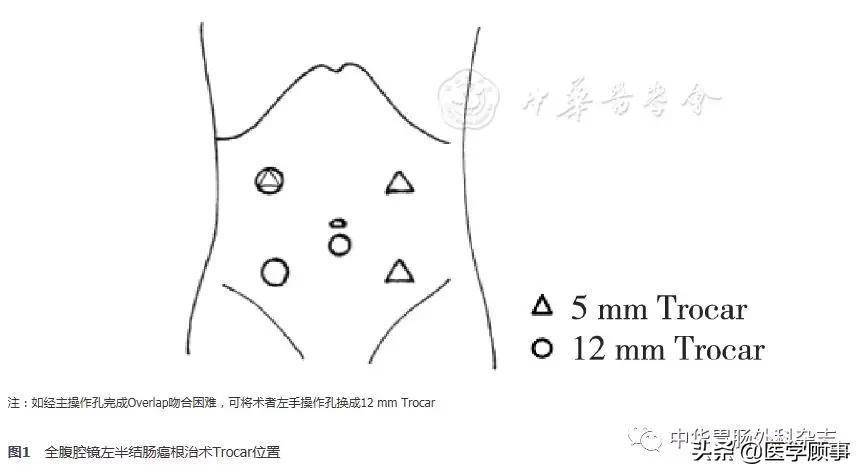 π吻合和overlap图片