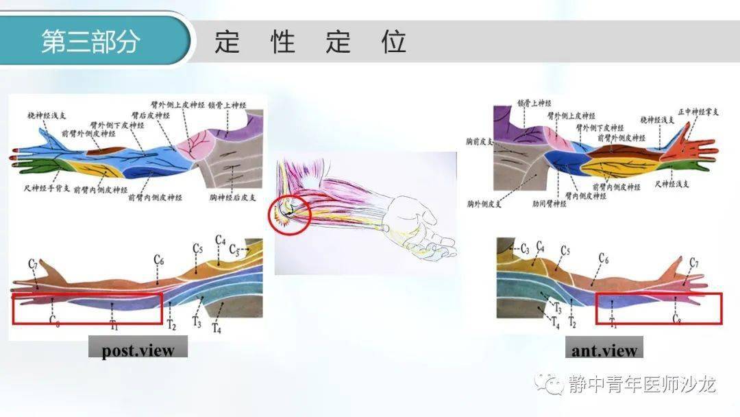 原创肘管综合征一例