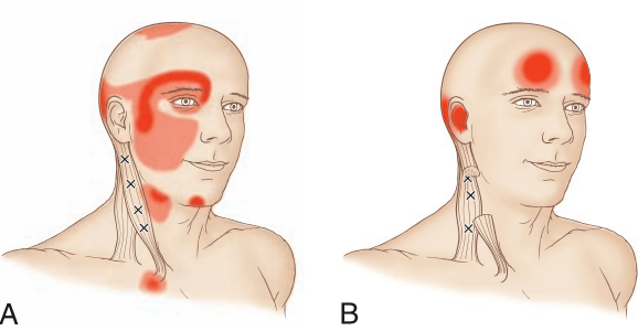 【每日一讲】第371期 副神经与自主神经的关系