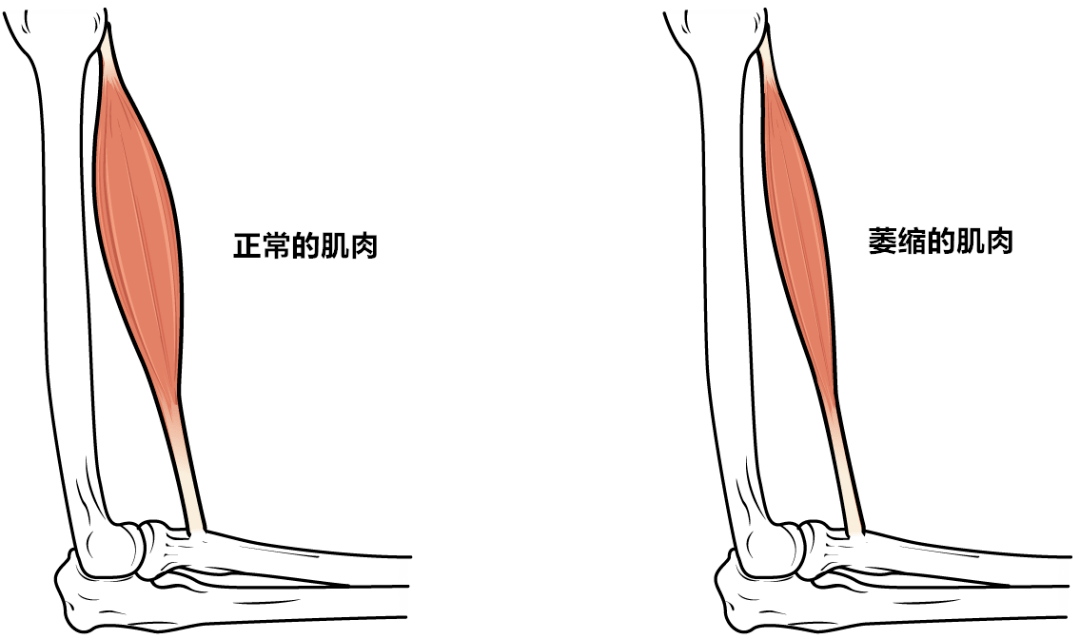 节律性,在去除神经支配后,该脏器的功能发生紊乱,但一般不发生萎缩;而